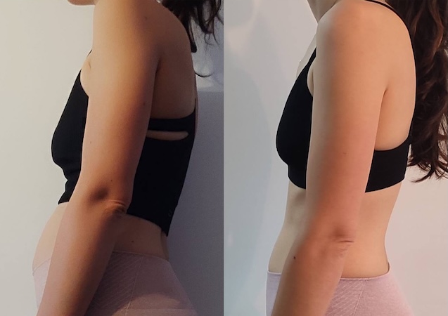 Transformação antes e depois 3