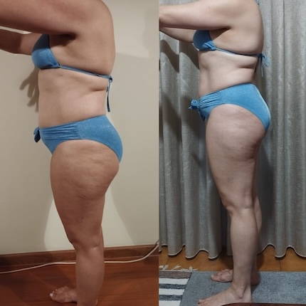 Transformação antes e depois 7